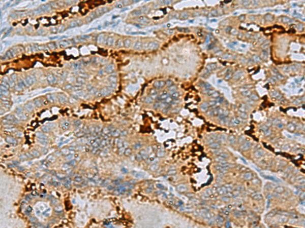 Polyclonal Rabbit anti-Human C16orf48 Antibody (IHC)