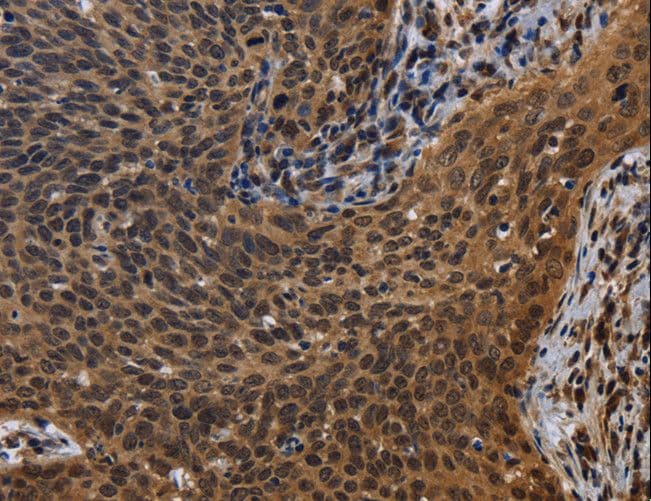 FHL3 Antibody