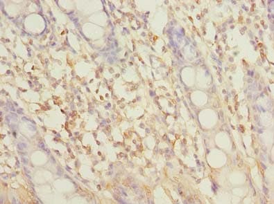 Polyclonal Rabbit anti-Human SLC6A16 Antibody (IHC)
