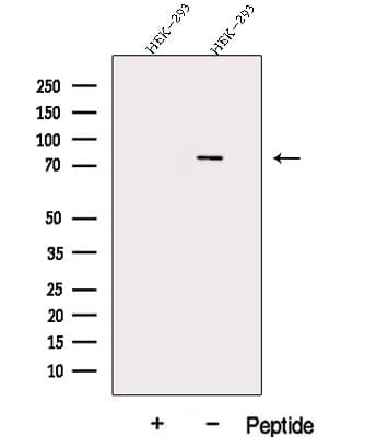 Polyclonal Rabbit anti-Human DDX17 Antibody (IF, WB)