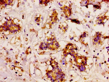 Polyclonal Rabbit anti-Human CD3EAP Antibody (IHC, IF, WB)