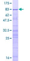Human SURF6 Protein (Recombinant GST)