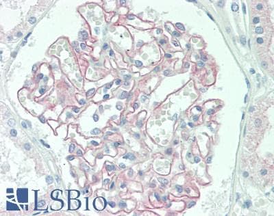 PDLIM2 / SLIM Antibody (clone OTI10C4)