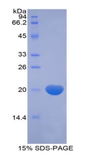 Human RXFP1/ LGR7 Protein (Recombinant His)