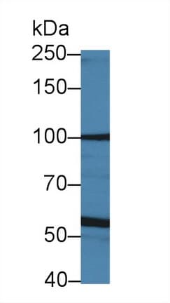LOXL4 / LOXC Antibody (aa399-552, PE)