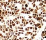 Polyclonal Rabbit anti-Human DNTT / TdT Antibody (IHC)