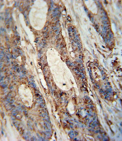 FAM46A Antibody (aa89-117)