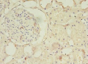 Polyclonal Rabbit anti-Human PDZD3 Antibody (IHC, WB)