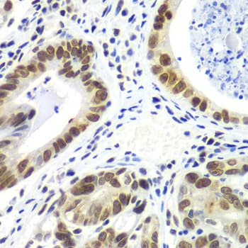 RNF2 / RING2 / RING1B Antibody