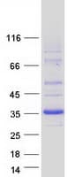 Human DHRS9 Protein (Recombinant Myc-DDK (Flag))