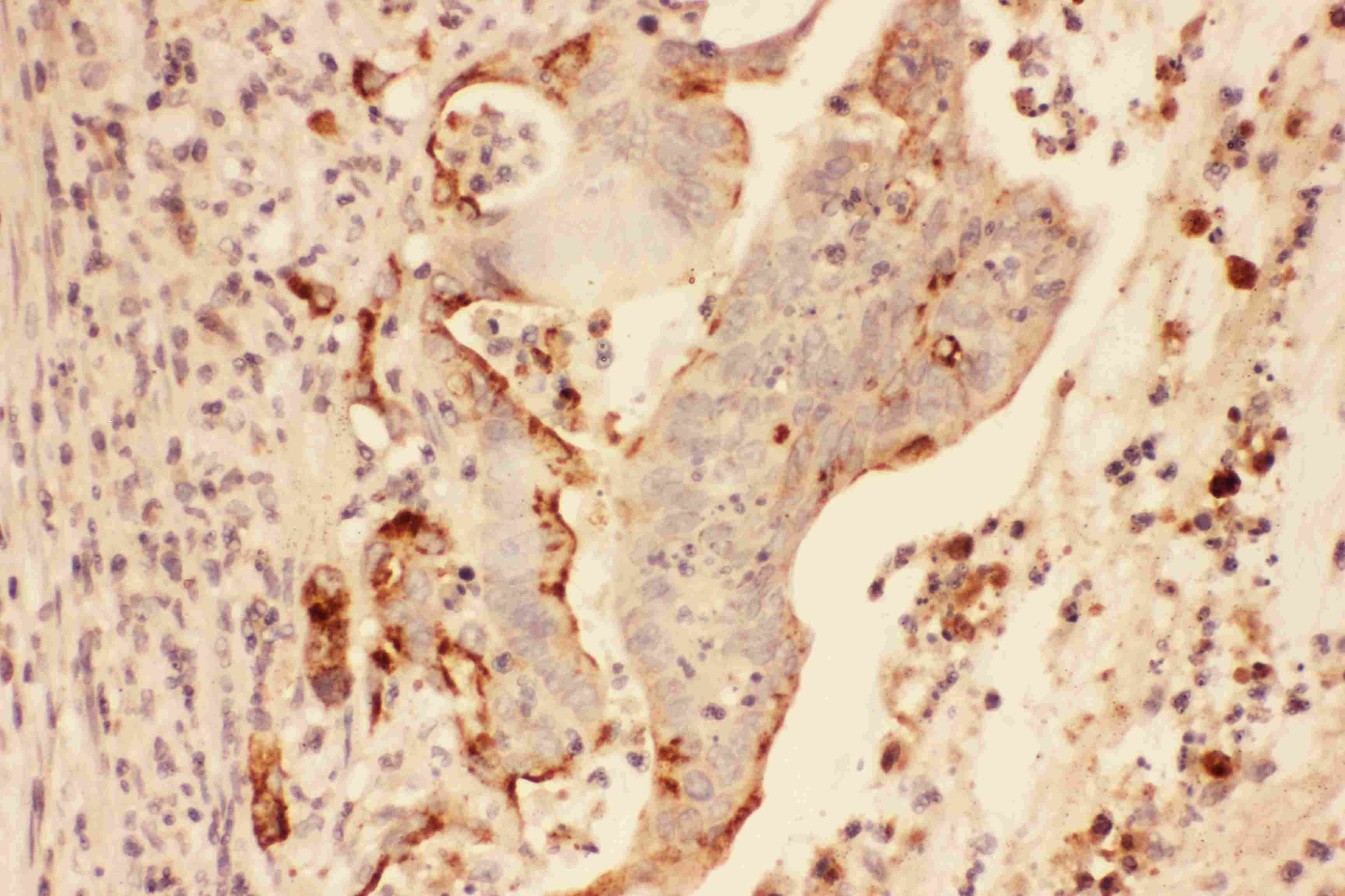Polyclonal Rabbit anti-Human MMP7 / Matrilysin Antibody (aa1-267, IHC, WB)