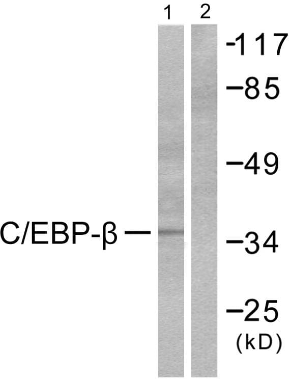 C/EBP Beta / CEBPB Antibody (p235/188)