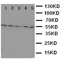 HYAL2 Antibody (aa142-157)
