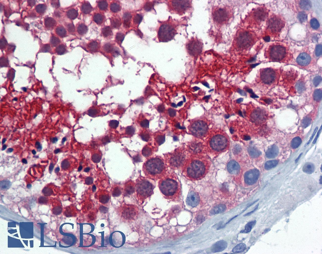 IHC-plus™ IPO5 / RANBP5 Antibody (clone 1C4)