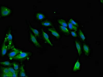 Polyclonal Rabbit anti-Human SNCAIP / Synphilin 1 Antibody (IHC, IF)