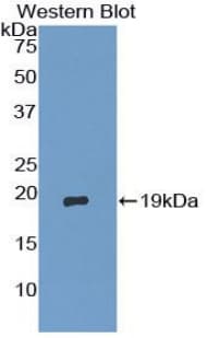 TSC22D3 / GILZ Antibody (aa1-134, APC)