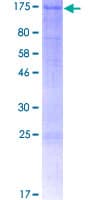 Human ULK1 Protein (Recombinant GST)
