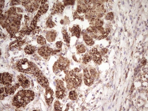 ERBB3 / HER3 Antibody (clone OTI1C6, Carrier-free)