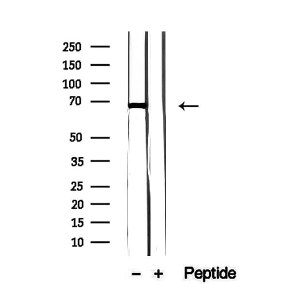 Polyclonal Rabbit anti-Human FAM65B / DIFF48 Antibody (IHC, WB)
