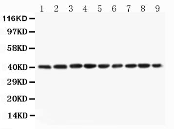 Polyclonal Rabbit anti-Human PON1 / ESA Antibody (aa186-201, WB)