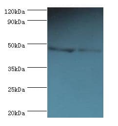 PLIN2 / ADFP / Adipophilin Antibody (aa168-437)