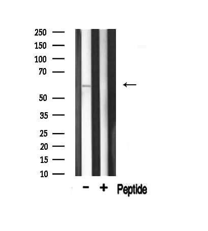 AKT1 Antibody (phospho-Thr308)