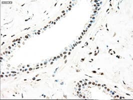 MAP2K4 / MKK4 Antibody (clone OTI4B4)
