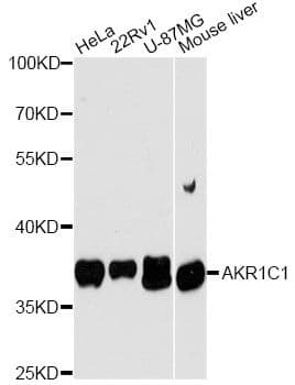 Polyclonal Rabbit anti-Human DDH / AKR1C1 Antibody (WB)