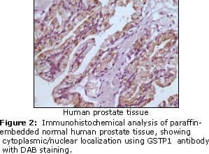 GSTP1 / GST Pi Antibody (clone 3F2C2)
