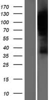 HURP / DLGAP5 Protein (Over-Expression Lysate Myc-DDK (Flag))