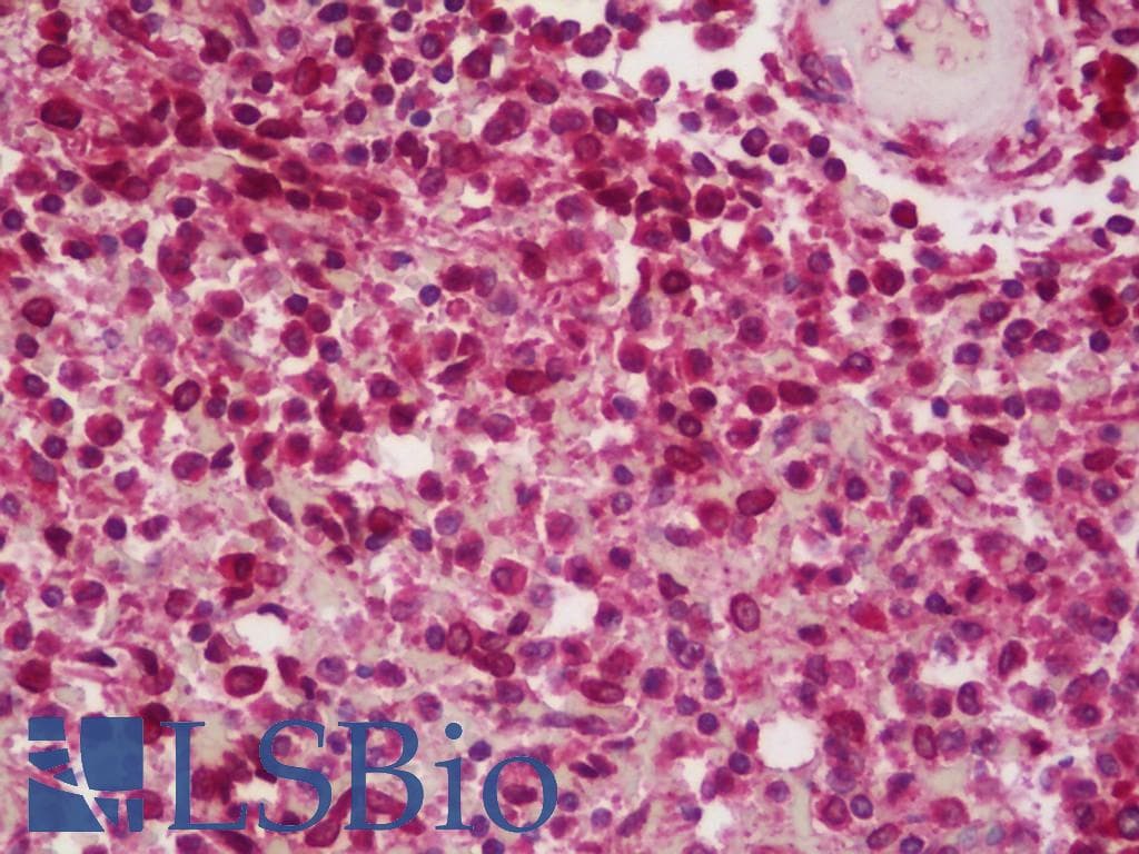 IHC-plus™ BCAR1 / p130Cas Antibody (aa275-325)