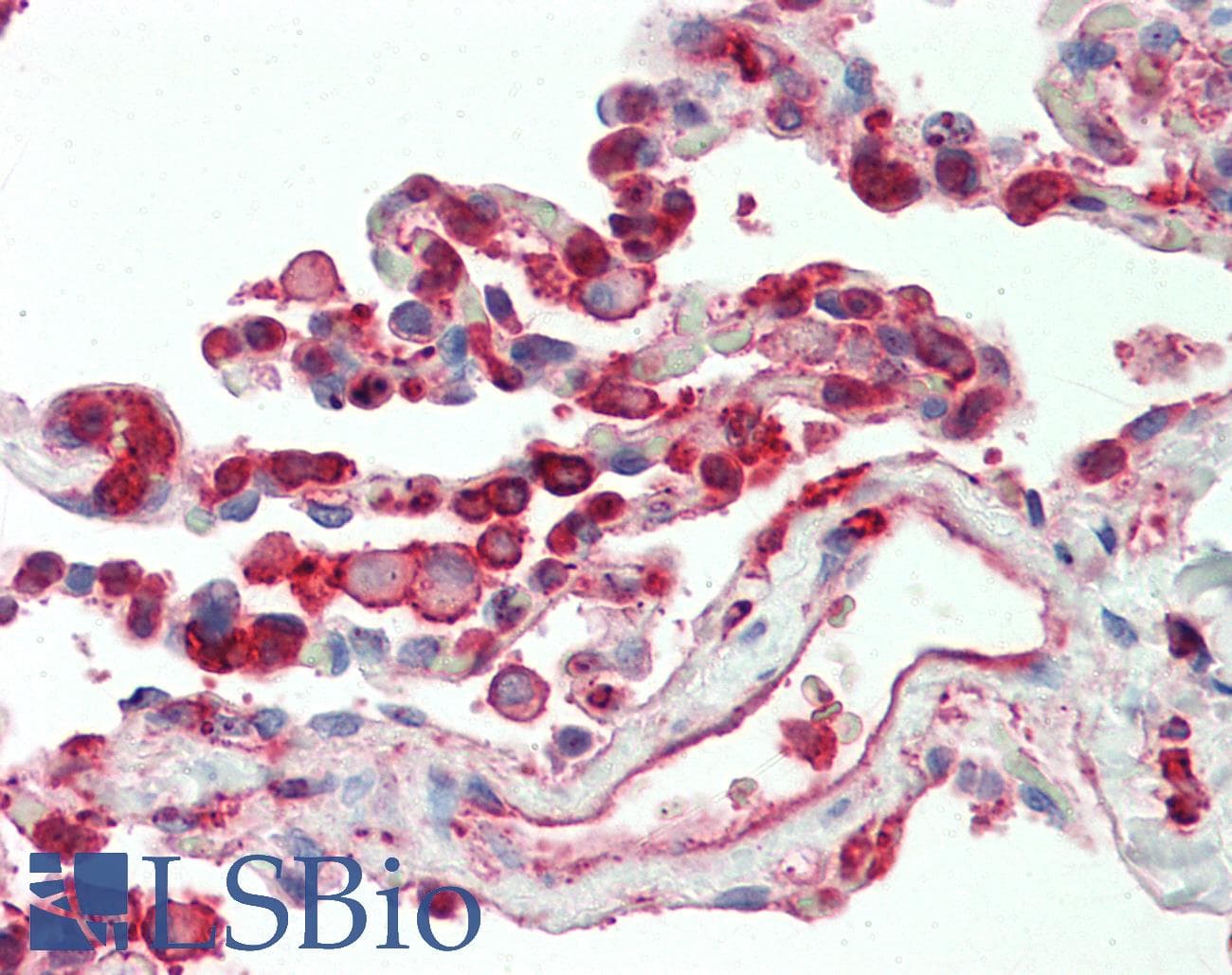 PathPlus™ Polyclonal Rabbit anti-Human CFL1 / Cofilin Antibody (aa4-32, IHC, WB)