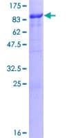 Human KIAA0226L Protein (Recombinant GST)
