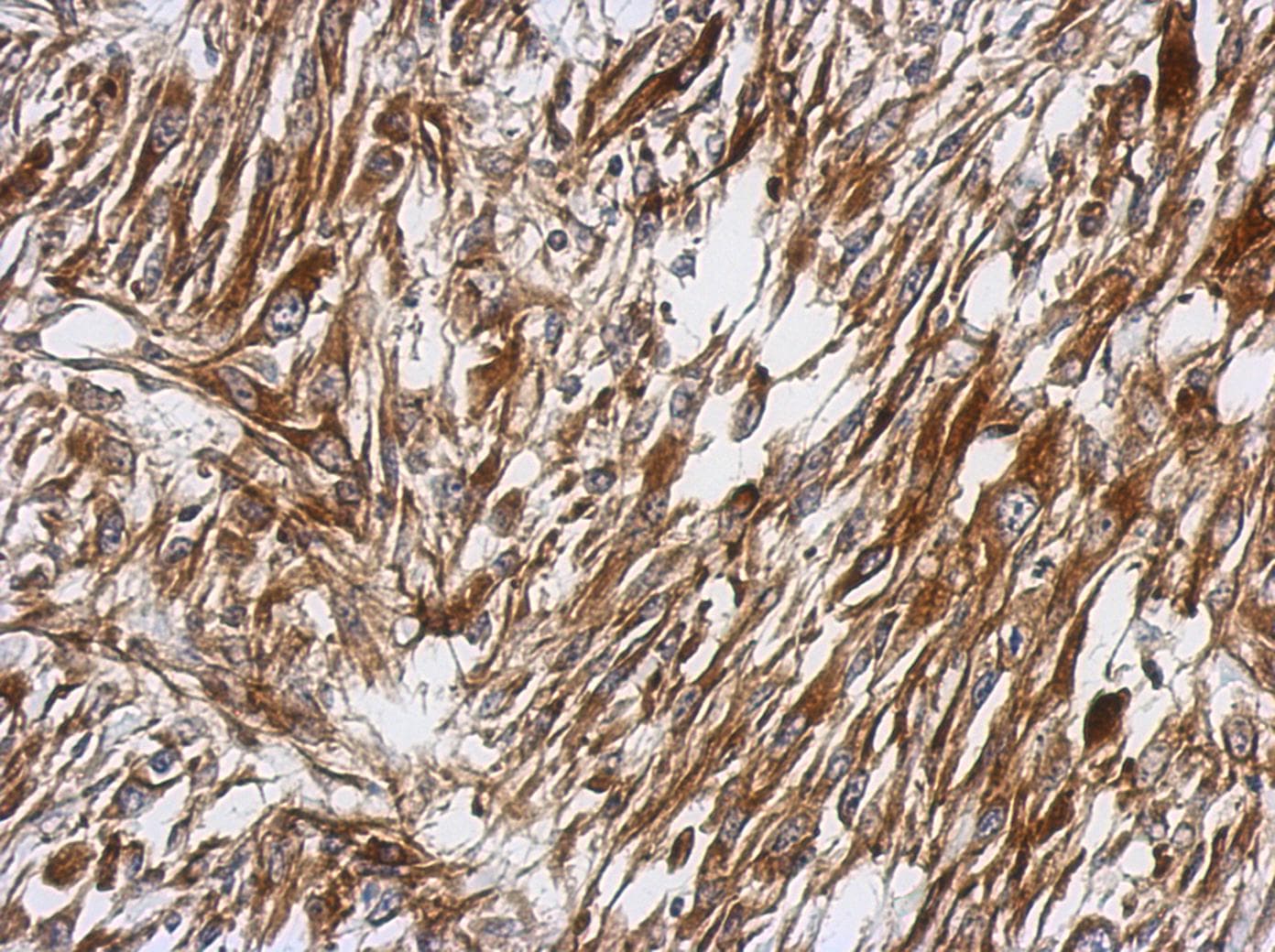PRKCQ / PKC-Theta Antibody