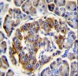 C12orf29 Antibody (aa61-89)