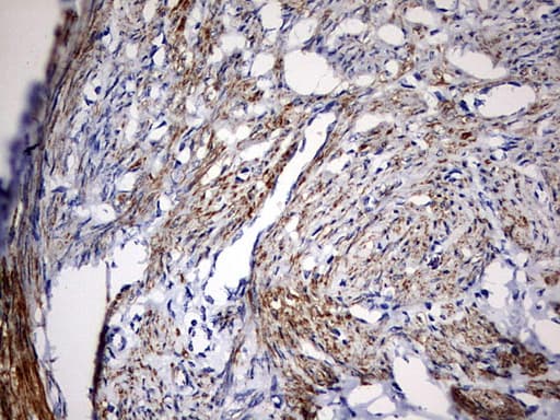 KLHL12 Antibody (aa177-405, clone OTI4E1)