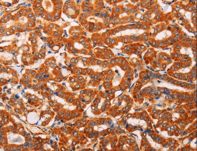 SLC25A4 / ANT Antibody