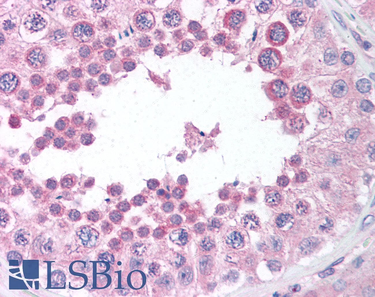 THOP1 / Thimet Oligopeptidase Antibody (aa56-72, clone 4D6, DY650)