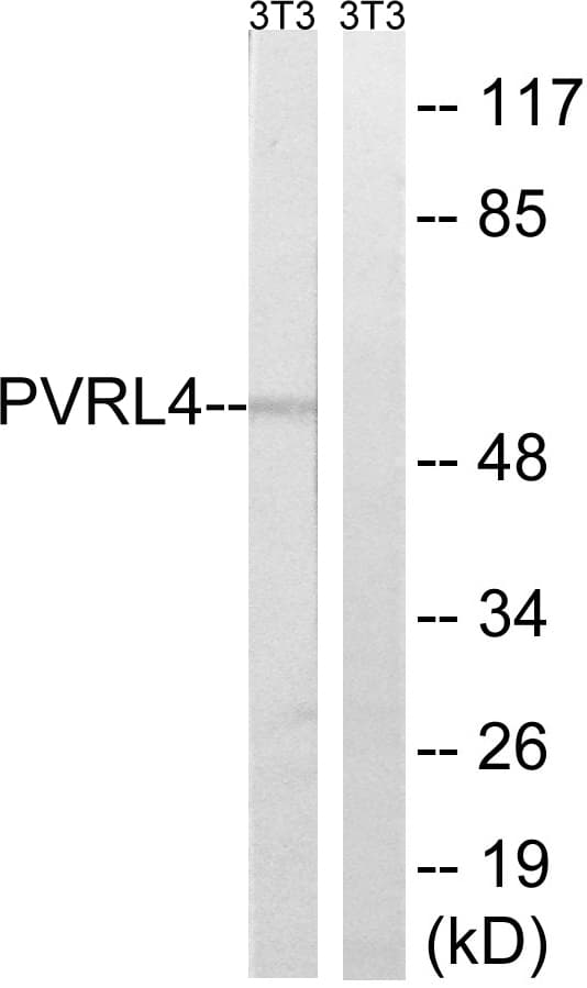 PVRL4 / Nectin 4 Antibody (aa312-361)