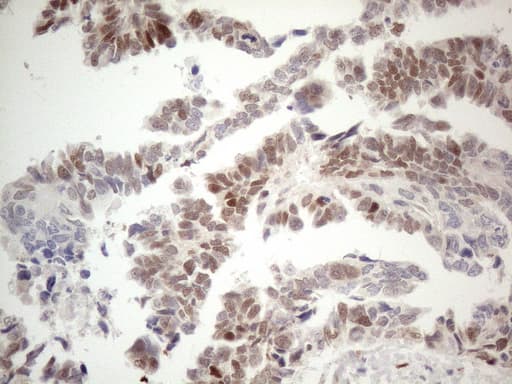 ER Alpha / Estrogen Receptor Antibody (aa1-310, clone OTI5E11, Carrier-free)