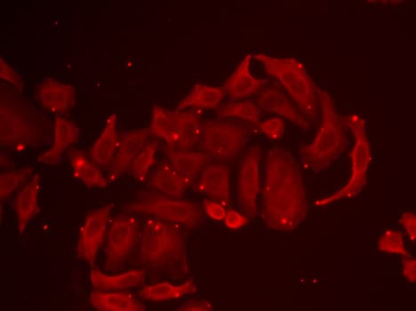 ECaC / TRPV5 Antibody