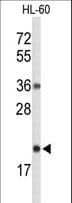 Polyclonal Rabbit anti-Human RNASEH2C / AGS3 Antibody (aa80-108, WB)