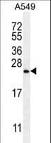 SNX24 Antibody (aa14-43)