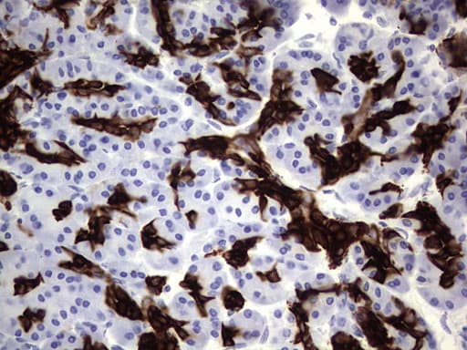 KRT19 / CK19 / Cytokeratin 19 Antibody (aa240-390, clone OTI8A1)