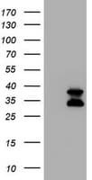 CD20 Antibody (clone OTI3C4)