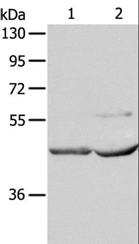 NCEH1 / AADACL1 Antibody