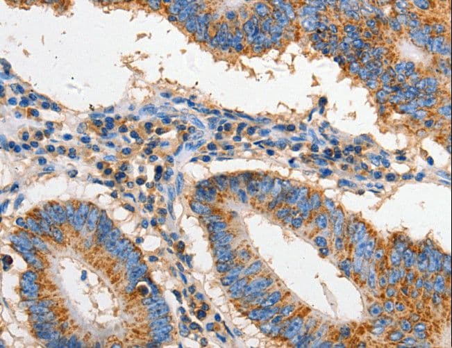 CD95 / FAS Antibody