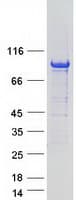 Human ARHGAP6 Protein (Recombinant Myc-DDK (Flag))