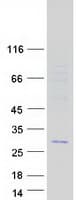 Human C11orf88 Protein (Recombinant Myc-DDK (Flag))