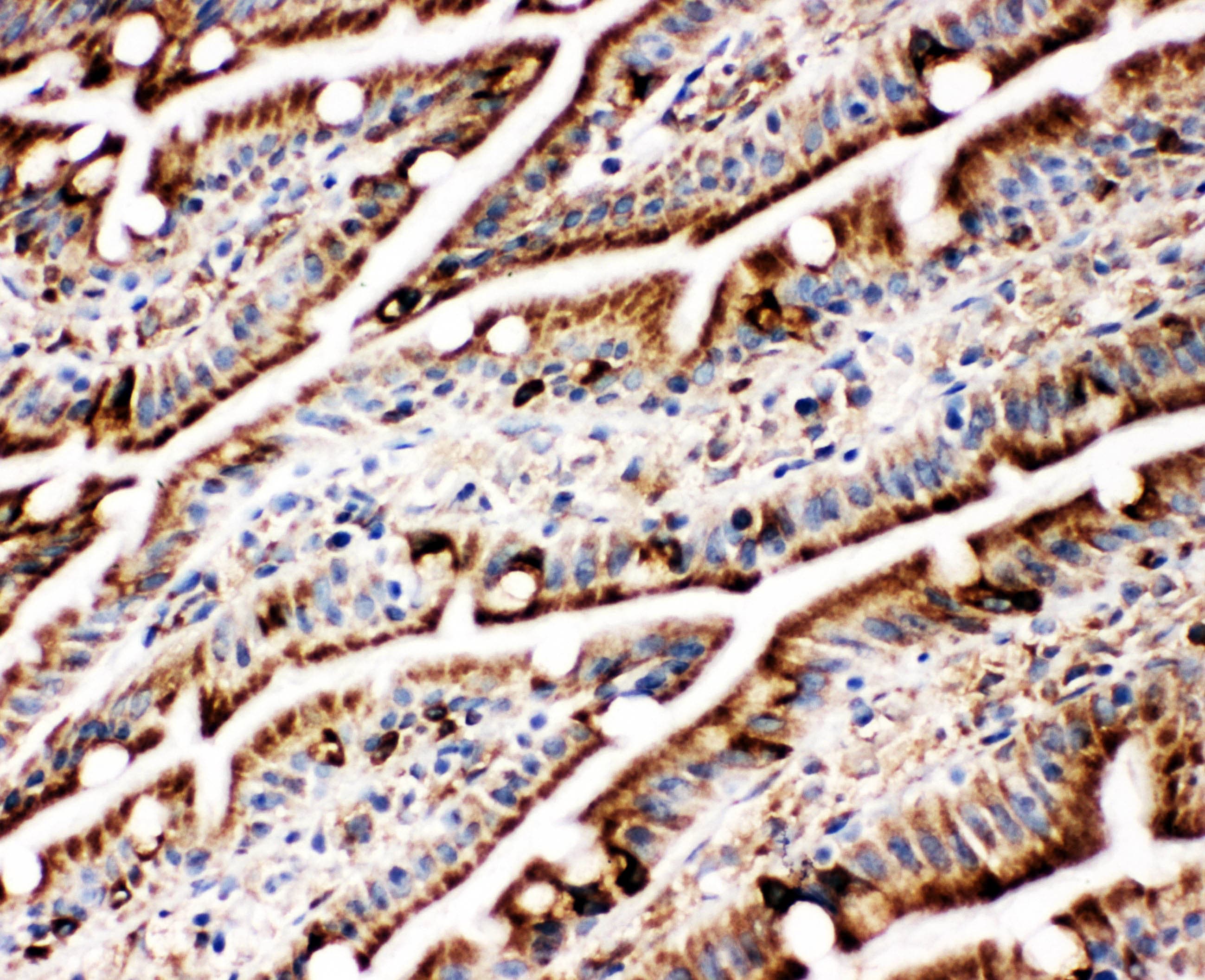 HSPA5 / GRP78 / BiP Antibody (aa603-617)